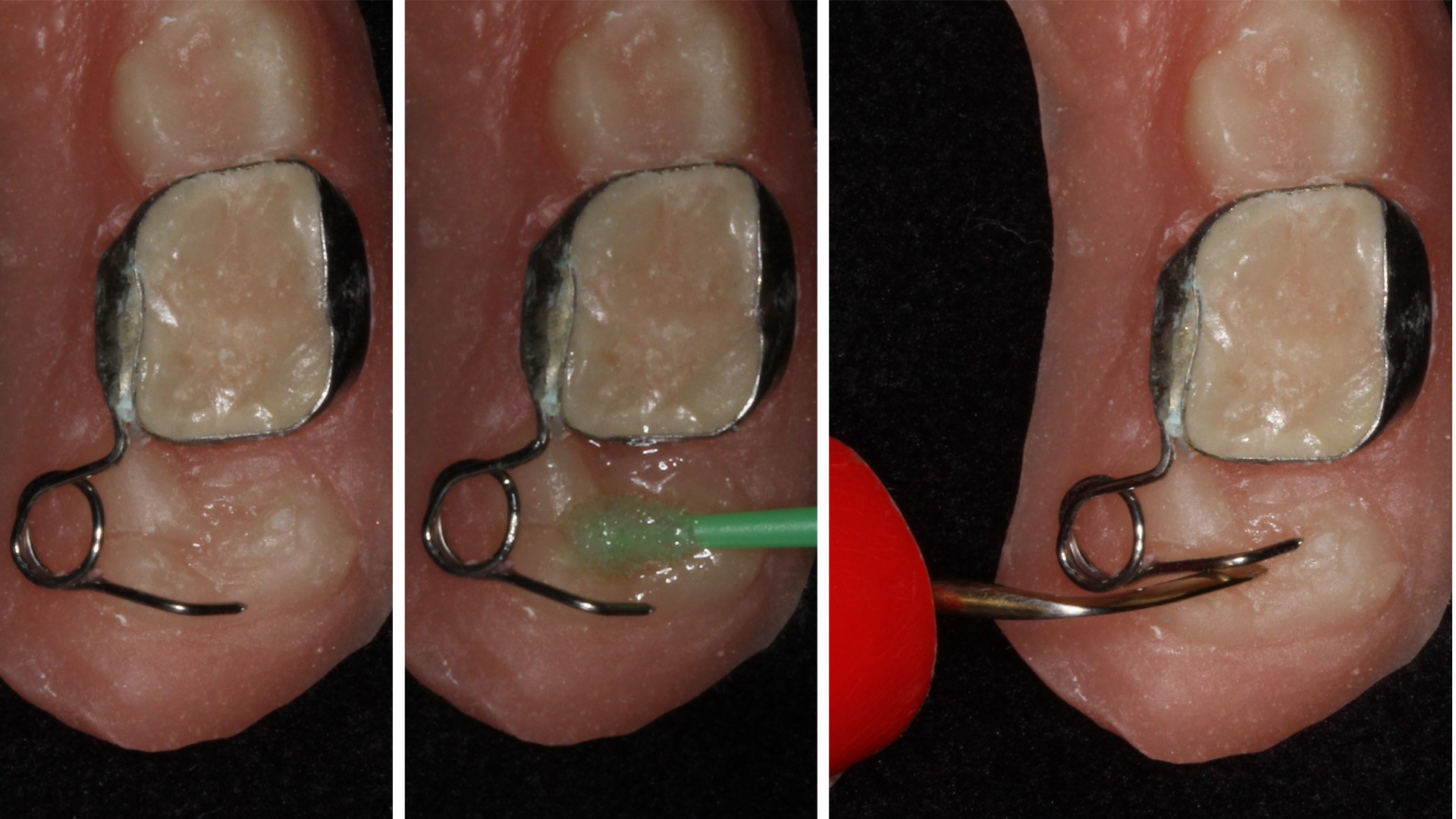 Módulo 01 – Conceitos, desenvolvimento normal da oclusão e anomalias dentárias