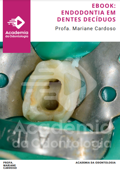 Endodontia em Dentes Decíduos