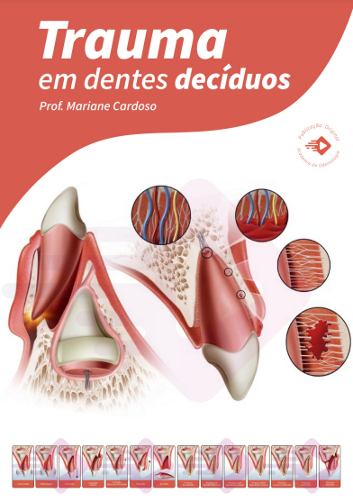 E-book Trauma em Dentes Decíduos