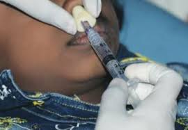 Midazolam intranasal ou nebulizado: Qual funciona melhor para acalmar crianças no dentista?
