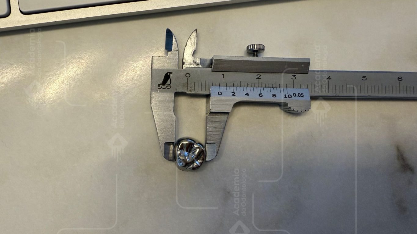 Dimensões Coronárias dos Dentes Decíduos no Brasil